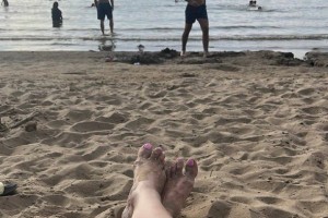 Аллергия на солнце: симптомы и последствия